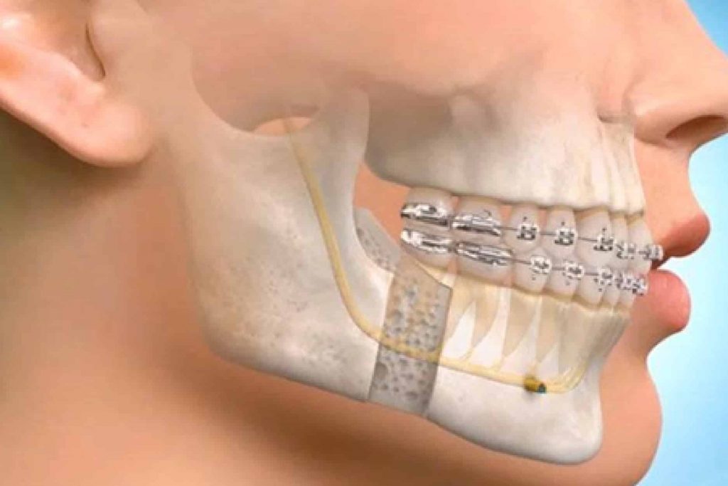 Maxillofacial Surgery Hospital In India Uttarkhand S Best Dental Hospital